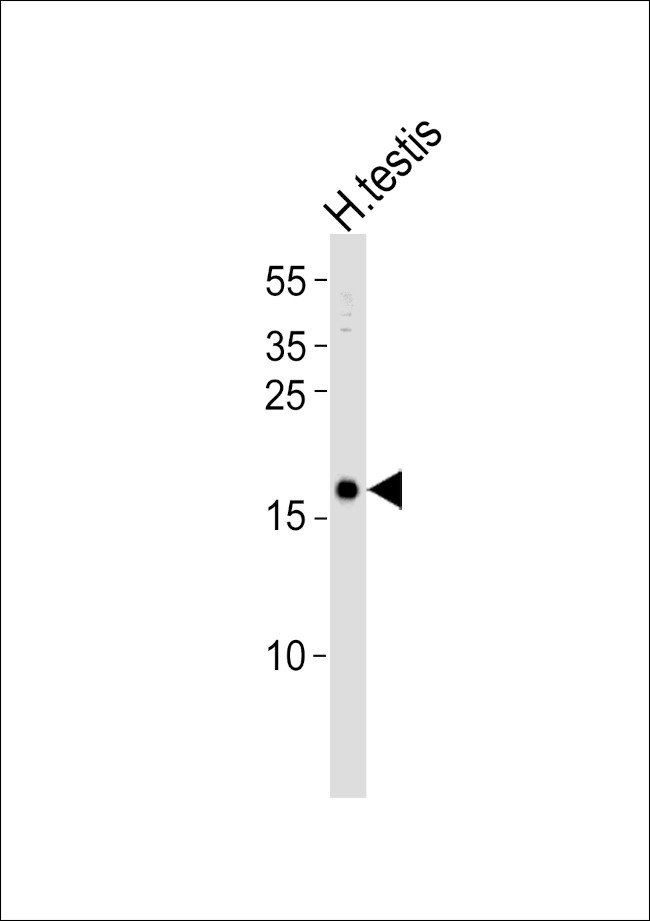 SPANXA1 Antibody in Western Blot (WB)