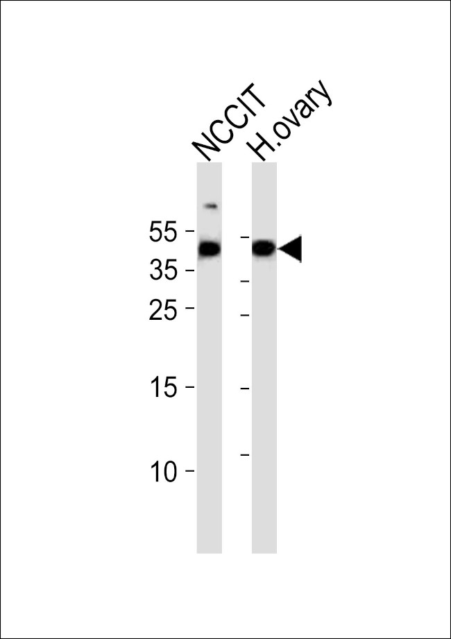 ESRG Antibody in Western Blot (WB)