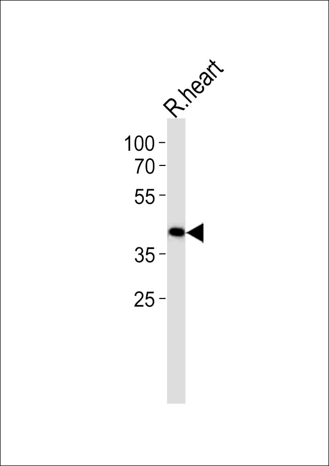 TOMM40L Antibody in Western Blot (WB)