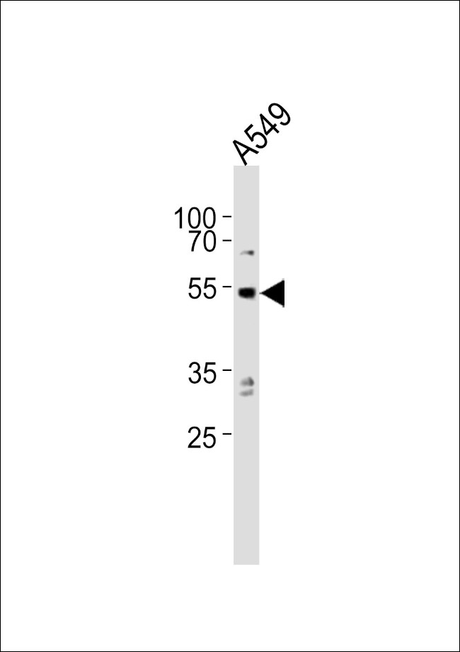 PPP2R2C Antibody in Western Blot (WB)