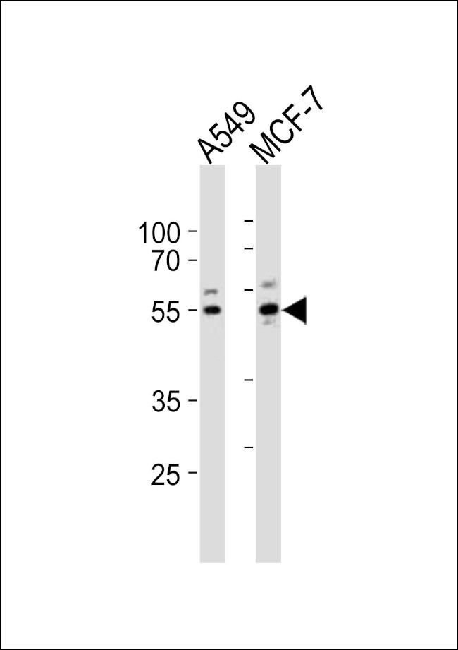 PPP2R2C Antibody in Western Blot (WB)