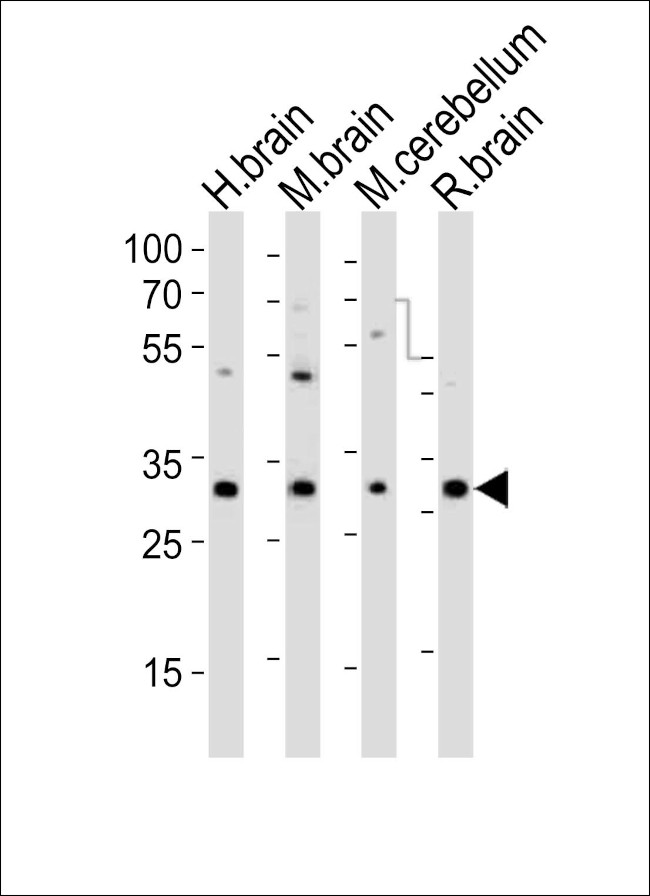 PCGF1 Antibody in Western Blot (WB)