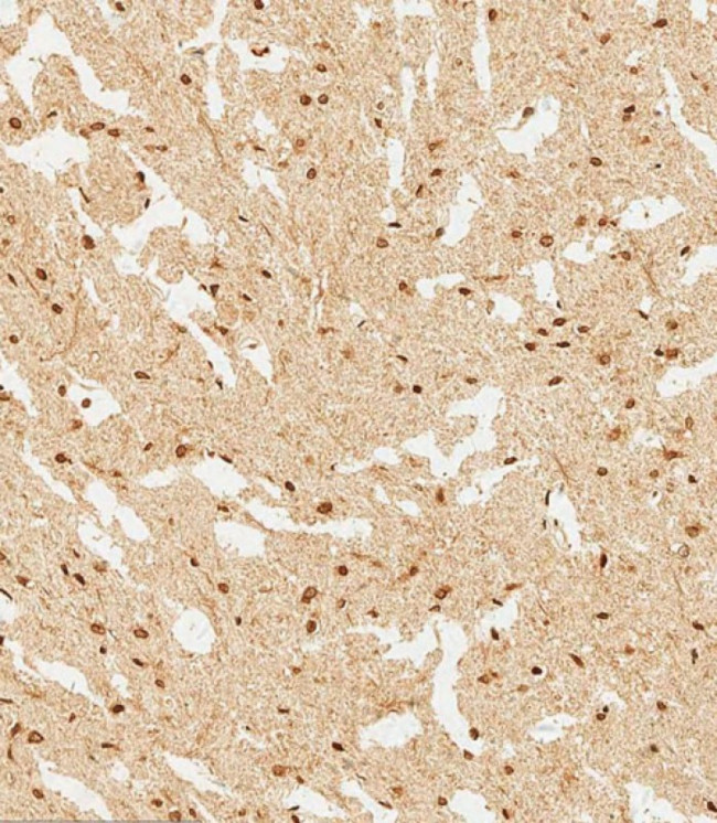 WDR82 Antibody in Immunohistochemistry (Paraffin) (IHC (P))