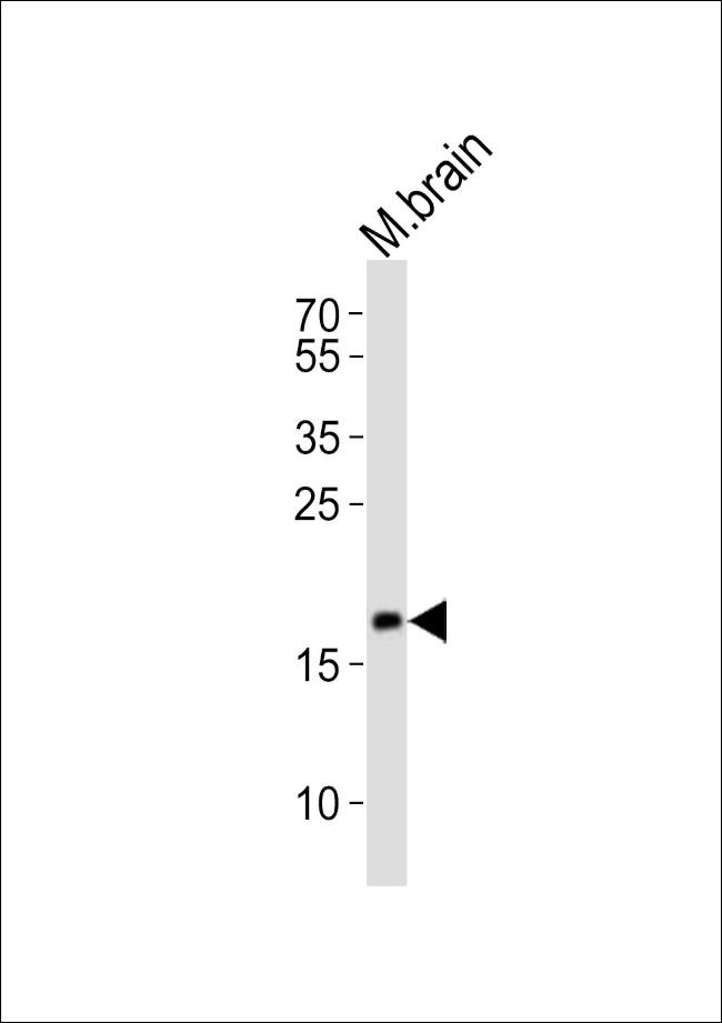 FAM168B Antibody in Western Blot (WB)