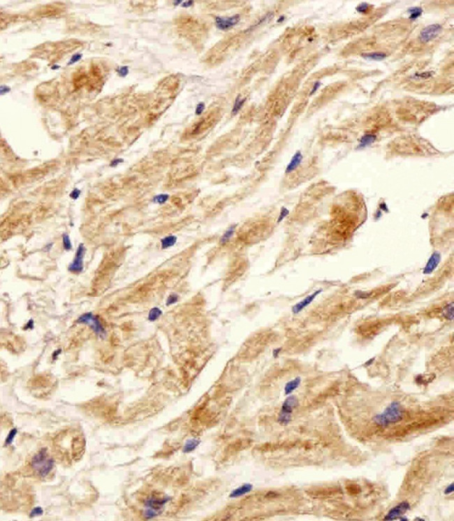 ITGB8 Antibody in Immunohistochemistry (Paraffin) (IHC (P))
