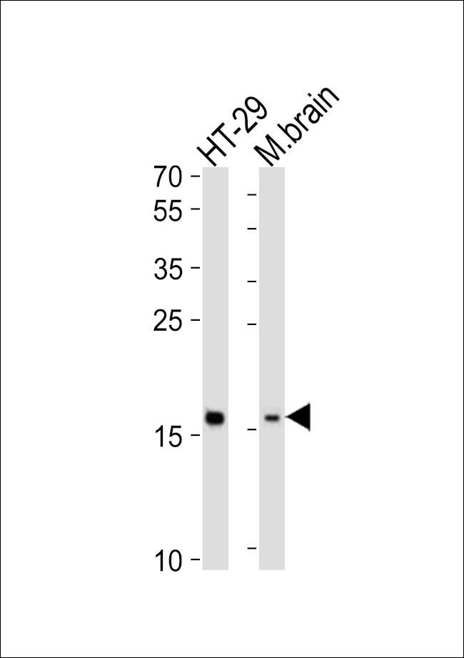 TMEM160 Antibody in Western Blot (WB)