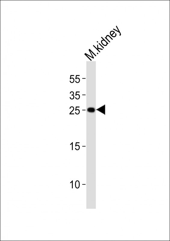 Claudin 6 Antibody in Western Blot (WB)