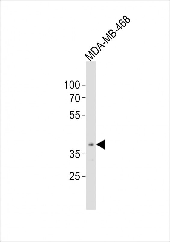 OR5A1 Antibody in Western Blot (WB)