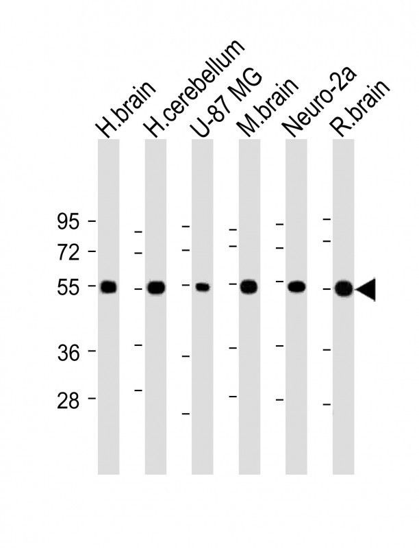 Neurexin-1-beta Antibody in Western Blot (WB)