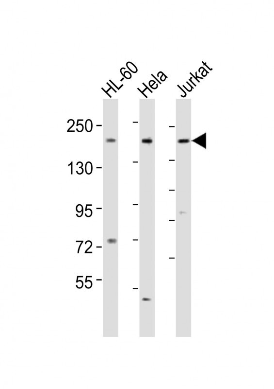 DIP2A Antibody in Western Blot (WB)