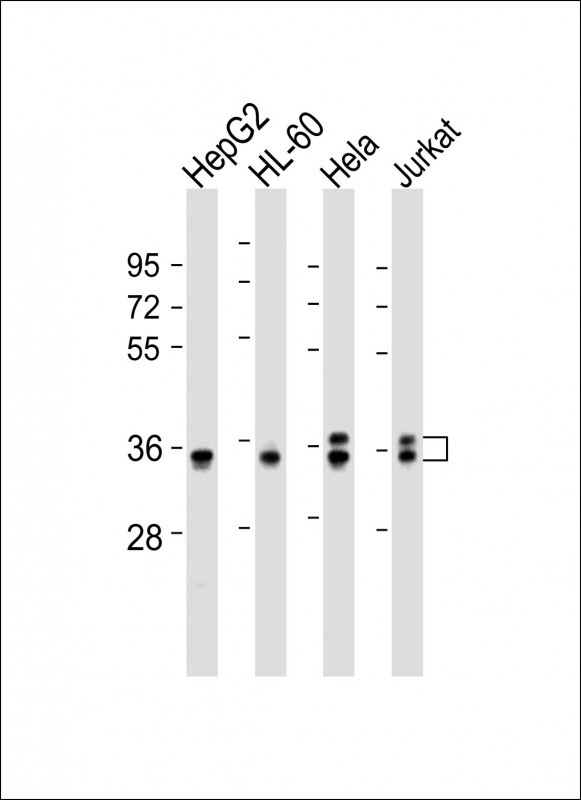 AKR7L Antibody in Western Blot (WB)