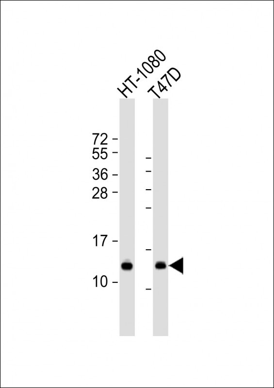 SPCS1 Antibody in Western Blot (WB)