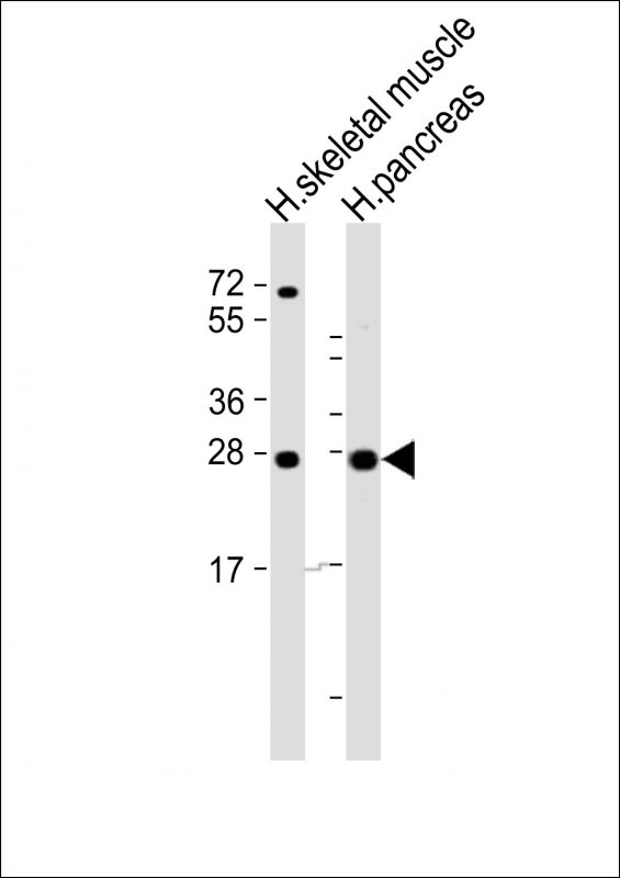 CELA2B Antibody in Western Blot (WB)