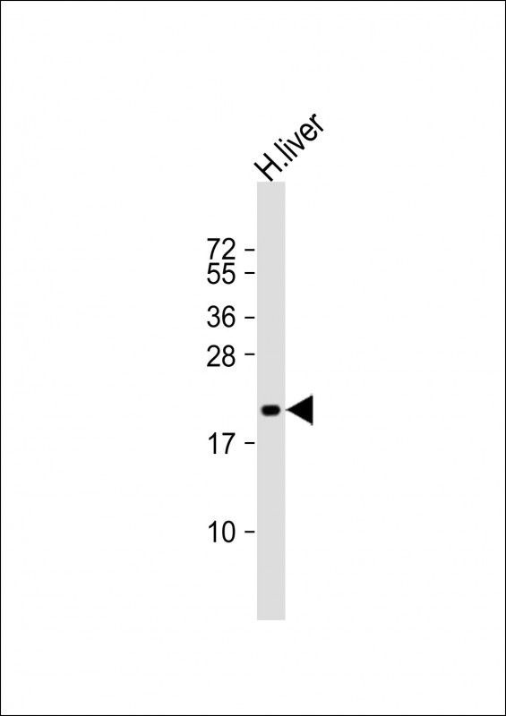 ROPN1 Antibody in Western Blot (WB)