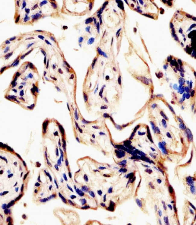ERVK-7 Antibody in Immunohistochemistry (Paraffin) (IHC (P))