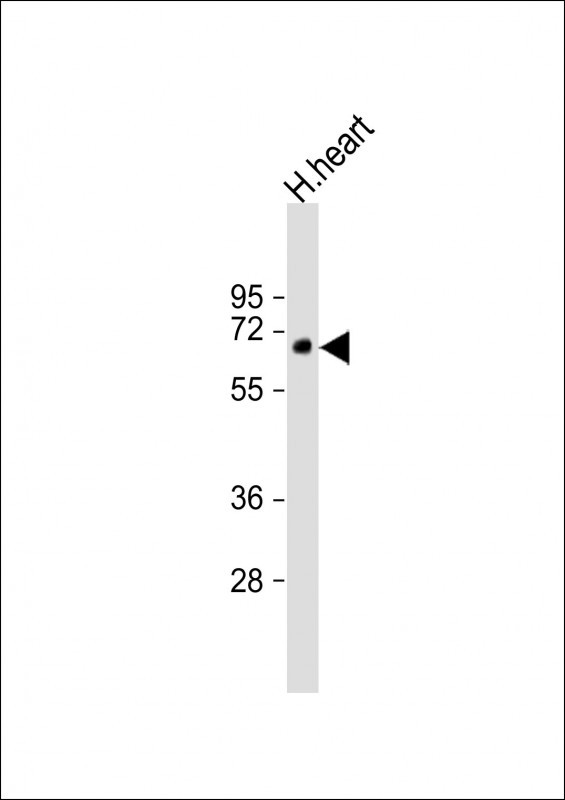 DVL1P1 Antibody in Western Blot (WB)