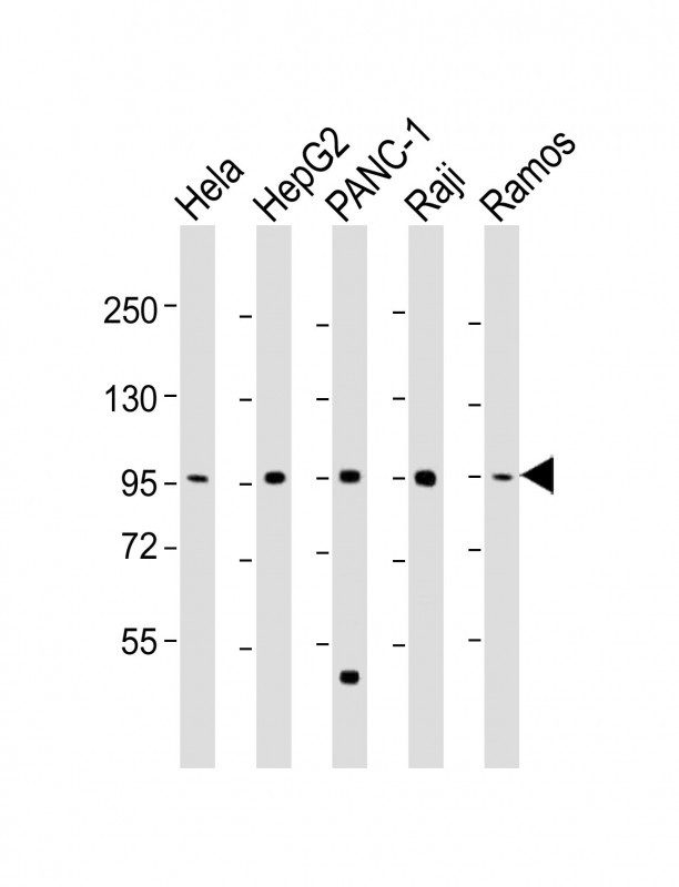 NUGGC Antibody in Western Blot (WB)