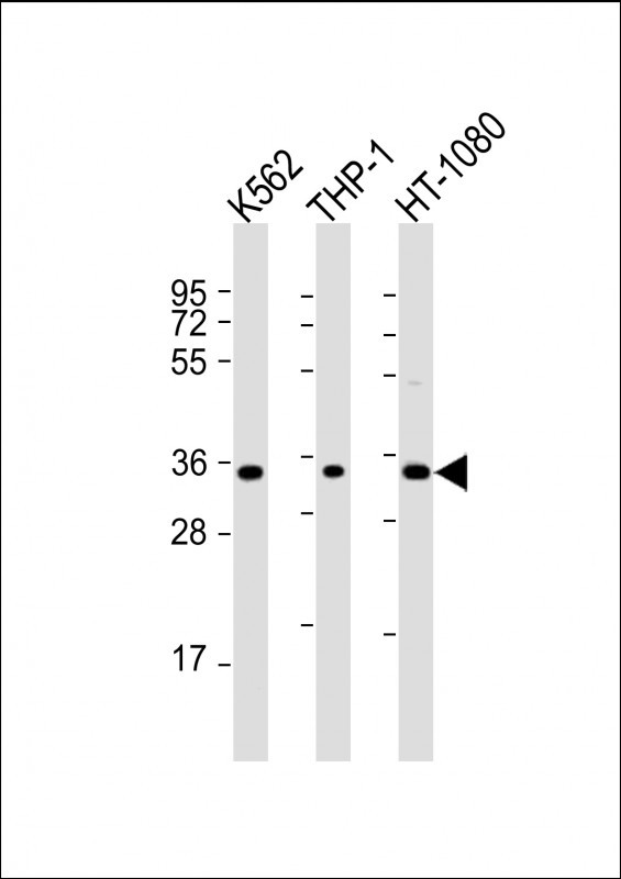 TMEM158 Antibody in Western Blot (WB)