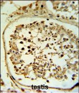 Fascin-3 Antibody in Immunohistochemistry (Paraffin) (IHC (P))