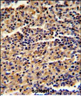 ALKBH8 Antibody in Immunohistochemistry (Paraffin) (IHC (P))