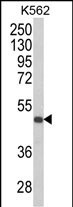 KIR3DS1 Antibody in Western Blot (WB)