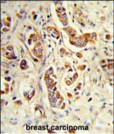 NCF1C Antibody in Immunohistochemistry (Paraffin) (IHC (P))