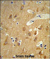 TSPAN12 Antibody in Immunohistochemistry (Paraffin) (IHC (P))