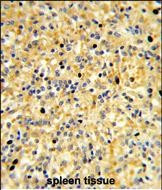 CCDC3 Antibody in Immunohistochemistry (Paraffin) (IHC (P))