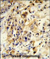 RPGRIP1 Antibody in Immunohistochemistry (Paraffin) (IHC (P))