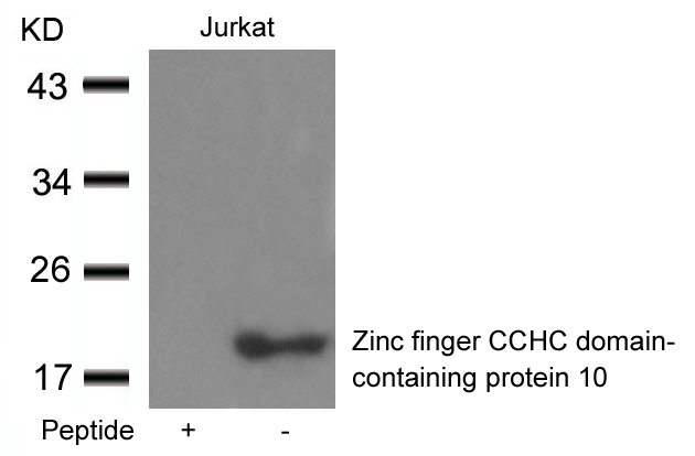 ZCCHC10 Antibody in Western Blot (WB)