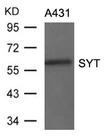 SS18 Antibody in Western Blot (WB)