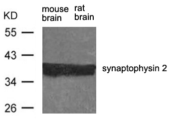 Synaptoporin Antibody in Western Blot (WB)