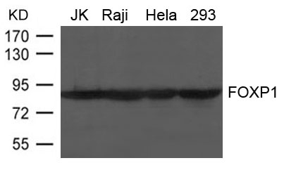 FOXP1 Antibody in Western Blot (WB)