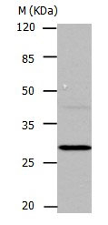 Carbonic Anhydrase I Antibody in Western Blot (WB)