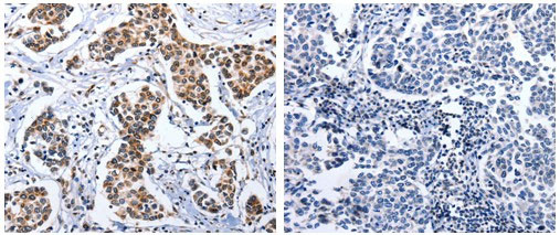 DOK3 Antibody in Immunohistochemistry (Paraffin) (IHC (P))