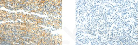 CFHR1 Antibody in Immunohistochemistry (Paraffin) (IHC (P))