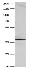 Heme oxygenase 2 Antibody in Western Blot (WB)