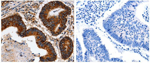 HSP90B2P Antibody in Immunohistochemistry (Paraffin) (IHC (P))
