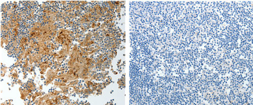PRCP Antibody in Immunohistochemistry (Paraffin) (IHC (P))