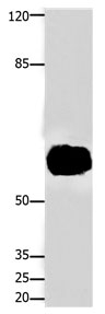 FOXJ3 Antibody in Western Blot (WB)