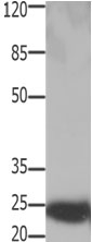 HMGB2 Antibody in Western Blot (WB)