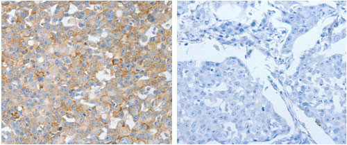 BPIL1 Antibody in Immunohistochemistry (Paraffin) (IHC (P))