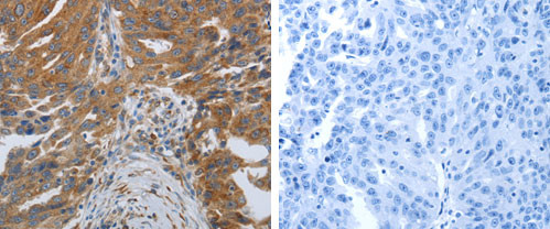 SPAG1 Antibody in Immunohistochemistry (Paraffin) (IHC (P))