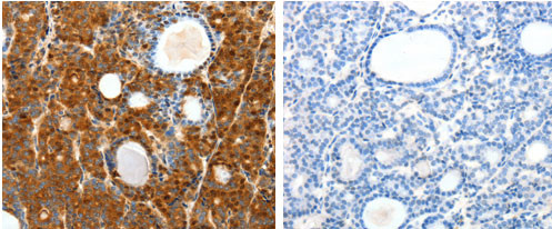 SCTR Antibody in Immunohistochemistry (Paraffin) (IHC (P))