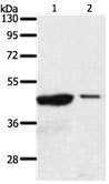 AADACL4 Antibody in Western Blot (WB)
