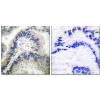 GUCY1B3 Antibody in Immunohistochemistry (Paraffin) (IHC (P))