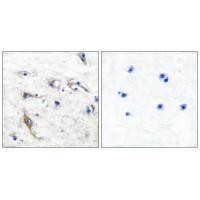 JM4 Antibody in Immunohistochemistry (Paraffin) (IHC (P))