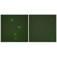 MCM5 Antibody in Immunocytochemistry (ICC/IF)