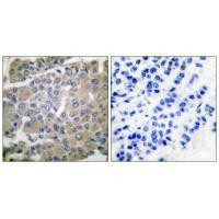 MMP8 Antibody in Immunohistochemistry (Paraffin) (IHC (P))