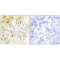 Cyclin L1 Antibody in Immunohistochemistry (Paraffin) (IHC (P))